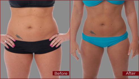 before and after boarder website home ABS before and after boarder website home ABS